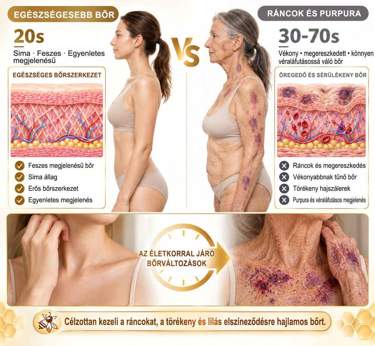 👉100K+ ELADVA -🧑‍⚕️PuraCure® méhpempő véraláfutás-javító és bőrerősítő krém (👍✅𝐂𝐄 𝐓𝐚𝐧ú𝐬í𝐭𝐯á𝐧𝐲)