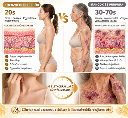 👉100K+ ELADVA -🧑‍⚕️PuraCure® méhpempő véraláfutás-javító és bőrerősítő krém (👍✅𝐂𝐄 𝐓𝐚𝐧ú𝐬í𝐭𝐯á𝐧𝐲)