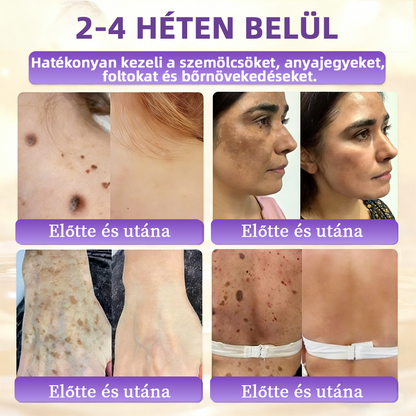 ✨ NORUION® Biotin 10 az 1-ben Bőrmegújító Krém  (👨‍⚕‍CE Tanúsítvány)👍✅ Magyar fejlesztés, magyarországi gyártás és szállítás