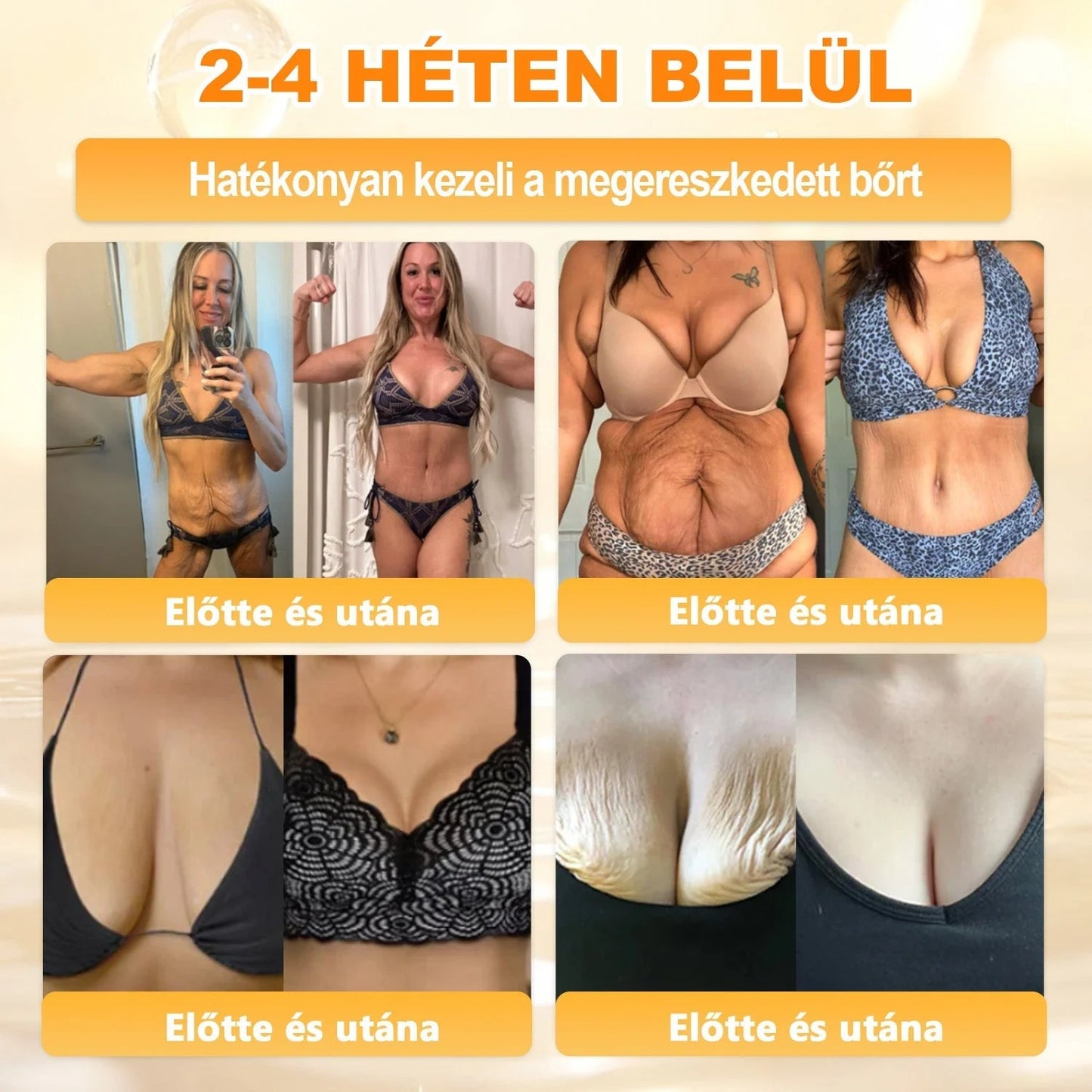 🔥🔥  𝐏𝐮𝐫𝐚𝐂𝐮𝐫𝐞® 𝐌é𝐡𝐦é𝐫𝐞𝐠 𝐁ő𝐫 𝐇𝐞𝐥𝐲𝐫𝐞á𝐥𝐥í𝐭ó 𝐊𝐫é𝐦 (👨‍⚕‍𝐂𝐄 𝐓𝐚𝐧ú𝐬í𝐭𝐯á𝐧𝐲)👍✅
