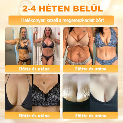 🔥🔥  𝐏𝐮𝐫𝐚𝐂𝐮𝐫𝐞® 𝐌é𝐡𝐦é𝐫𝐞𝐠 𝐁ő𝐫 𝐇𝐞𝐥𝐲𝐫𝐞á𝐥𝐥í𝐭ó 𝐊𝐫é𝐦 (👨‍⚕‍𝐂𝐄 𝐓𝐚𝐧ú𝐬í𝐭𝐯á𝐧𝐲)👍✅