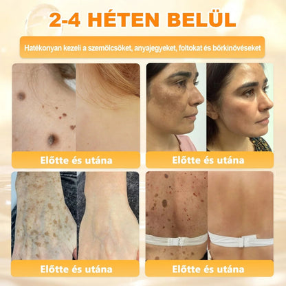 🔥🔥  𝐏𝐮𝐫𝐚𝐂𝐮𝐫𝐞® 𝐌é𝐡𝐦é𝐫𝐞𝐠 𝐁ő𝐫 𝐇𝐞𝐥𝐲𝐫𝐞á𝐥𝐥í𝐭ó 𝐊𝐫é𝐦 (👨‍⚕‍𝐂𝐄 𝐓𝐚𝐧ú𝐬í𝐭𝐯á𝐧𝐲)👍✅