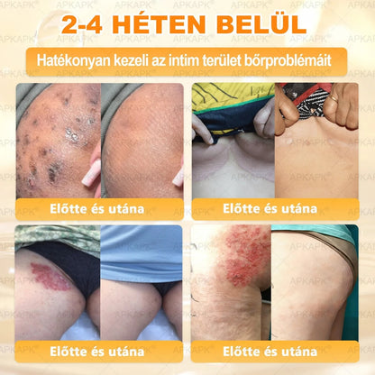 🔥🔥  𝐏𝐮𝐫𝐚𝐂𝐮𝐫𝐞® 𝐌é𝐡𝐦é𝐫𝐞𝐠 𝐁ő𝐫 𝐇𝐞𝐥𝐲𝐫𝐞á𝐥𝐥í𝐭ó 𝐊𝐫é𝐦 (👨‍⚕‍𝐂𝐄 𝐓𝐚𝐧ú𝐬í𝐭𝐯á𝐧𝐲)👍✅