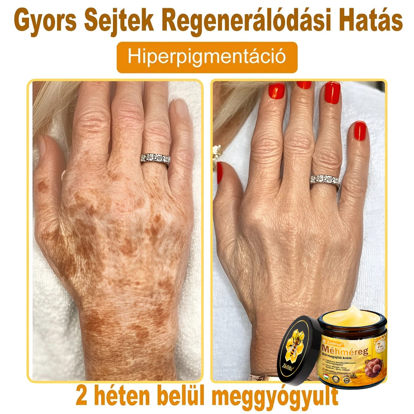 🐝 ZödVita® Méhméreg Bőr Helyreállító Krém (👨‍⚕‍CE Tanúsítvány)👍✅