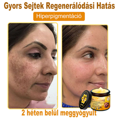 ✨ ZödVita® Méhméreg Bőr Helyreállító Krém 🔥 Magyar fejlesztés, magyarországi gyártás és szállítás